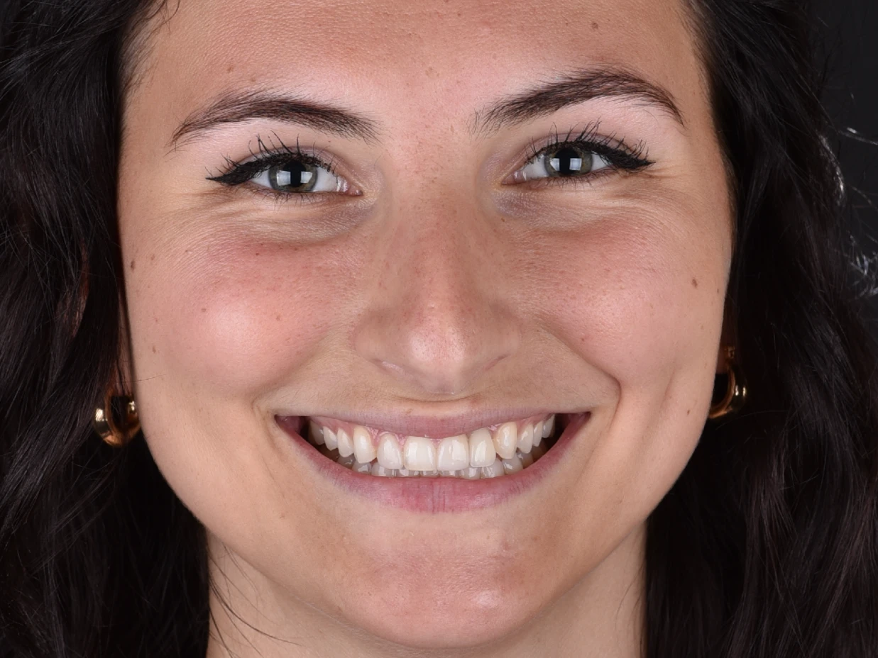 Orthodontic Before and After Pictures: Real Smile Transformations