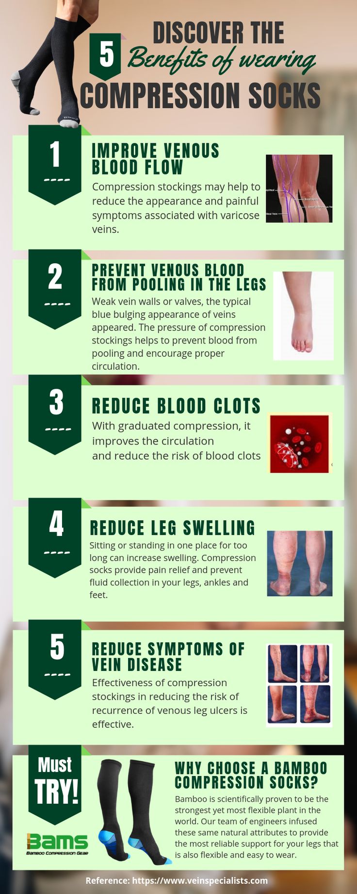Thigh High Support Socks: Benefits Compression Levels and Fit Guide