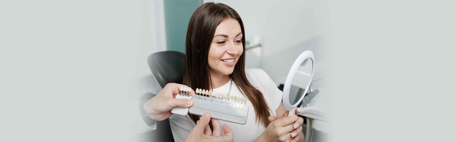 Composite Veneers After 5 Years: Longevity Maintenance and Real Results