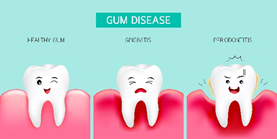 How Long Does a Hygienist Appointment Take? Time and What to Expect