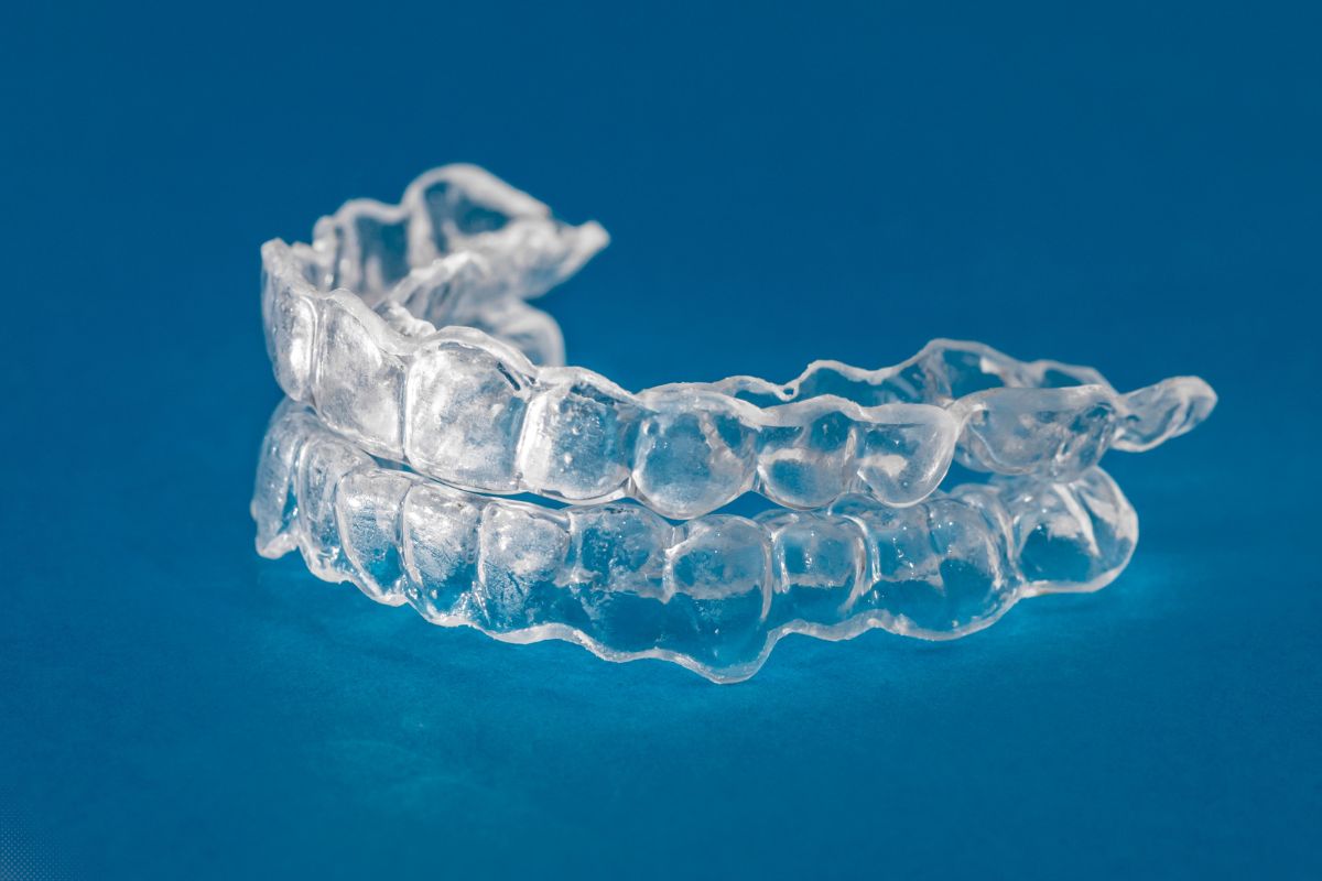 How Long Do Aligners Take to Work? Invisalign Timeline Explained