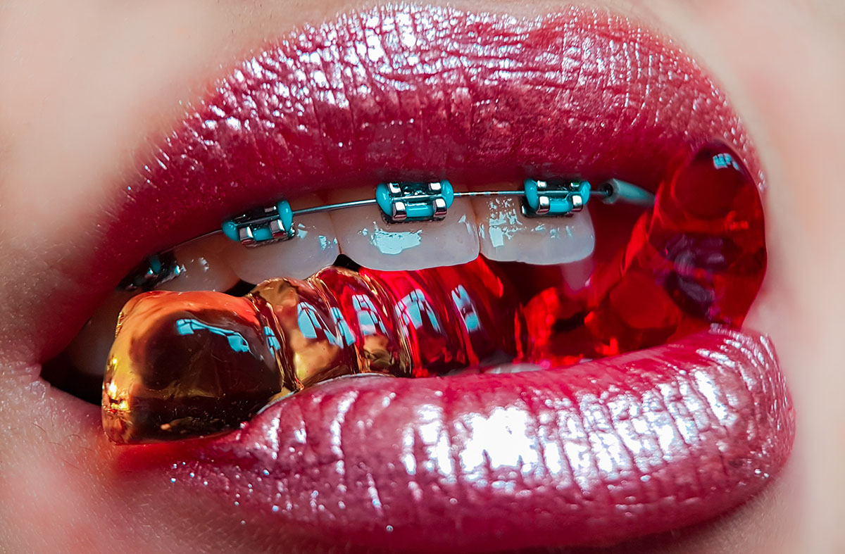 Do I Need Braces? Take This Quick Orthodontic Quiz