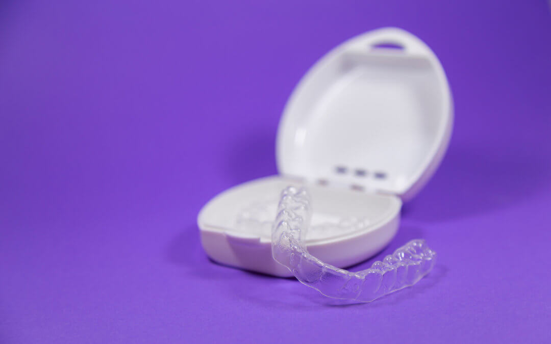 How Long Does Invisalign Take to Work? Results Timeline Explained