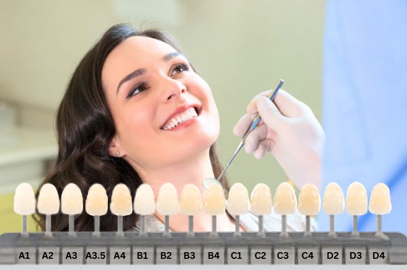 Is B1 Tooth Shade Too White? Dentist Advice on Natural Smile Color